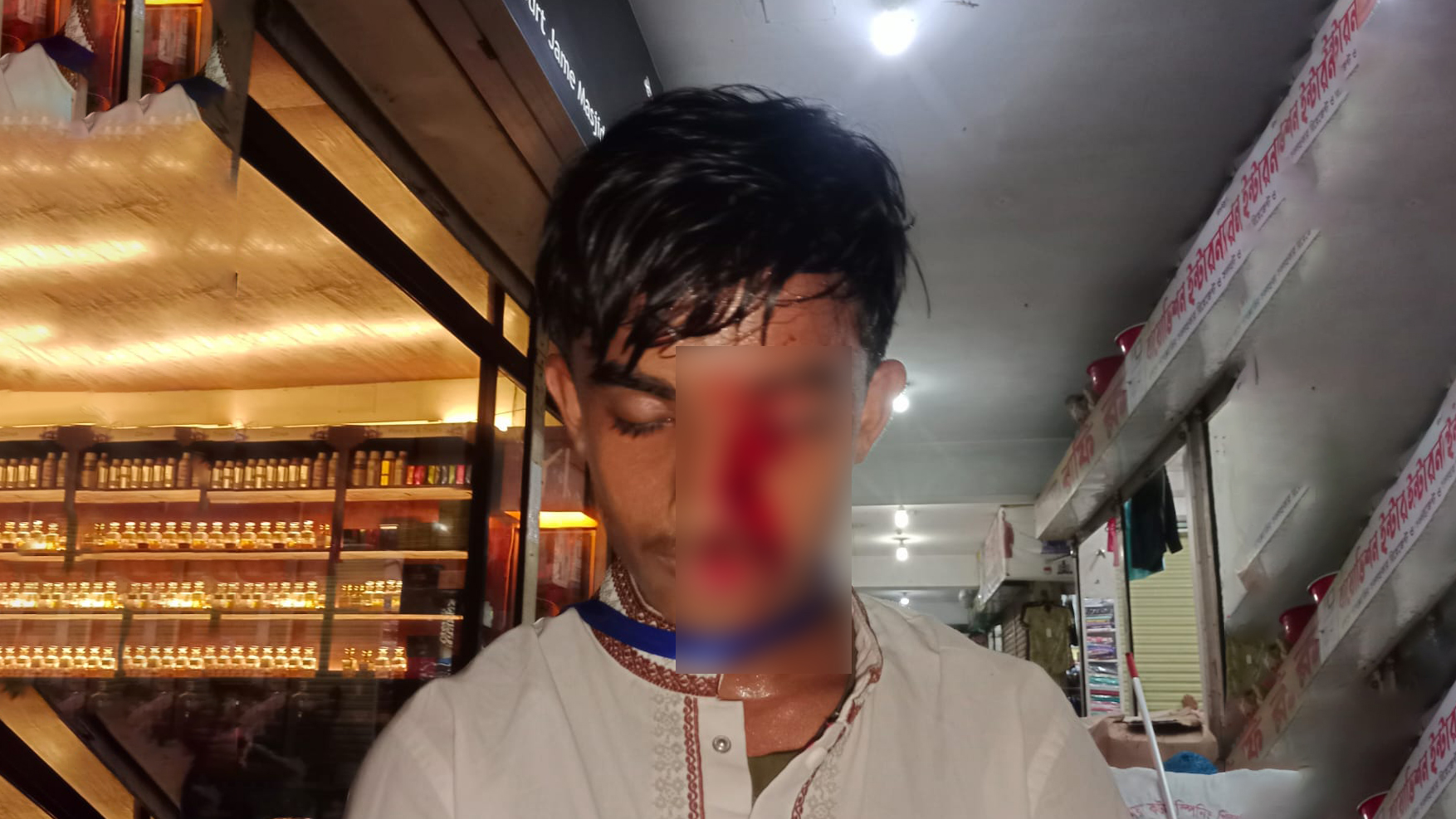 হবিগঞ্জে চোখে আঘাতপ্রাপ্ত ছাত্রশক্তির নেতাকে উড়োজাহাজে ঢাকায় আনা হচ্ছে