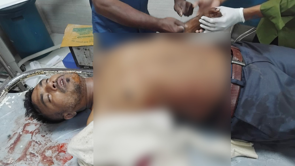 বগুড়ায় বাজার সমিতির সাধারণ সম্পাদক প্রার্থীকে তুলে নিয়ে হাত-পা ভেঙে দিয়েছে দুর্বৃত্তরা