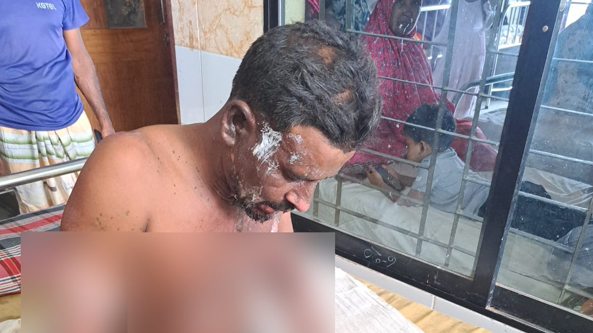 সাক্ষীর গায়ে পেট্রল ঢেলে আগুন, মাদক মামলার আসামিকে পুলিশে দিল জনতা