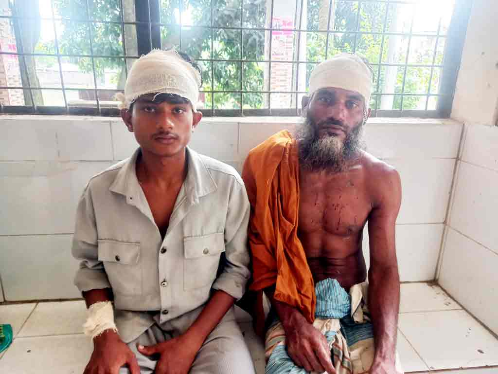 সোনারগাঁয়ে পৈতৃক সম্পত্তি নিয়ে বিরোধে বাবা ও দুই ছেলেকে পিটিয়ে জখম