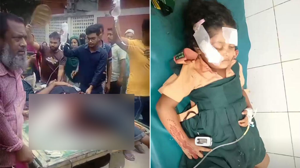 কেটে বিচ্ছিন্ন হয়ে গেছে বাবা-মেয়ের পা, হাত ভেঙেছে অন্তঃসত্ত্বা মায়ের
