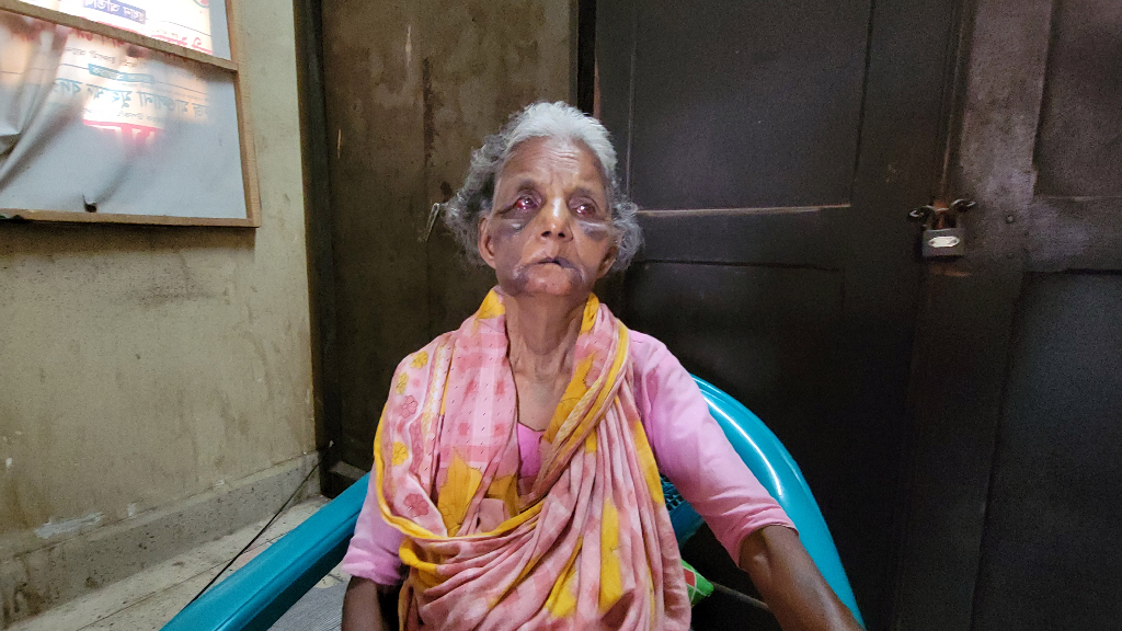 রেলস্টেশনের বাক্প্রতিবন্ধী বৃদ্ধাকে কিলঘুষি, ভিক্ষা করে জমানো টাকা লুট