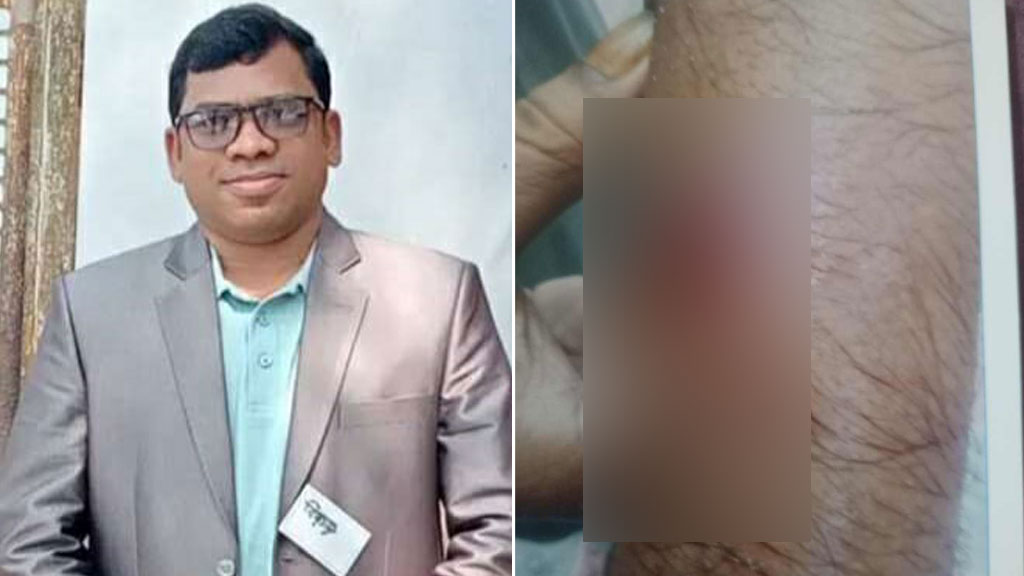 প্রধান শিক্ষককে কামড় দিলেন দপ্তরি