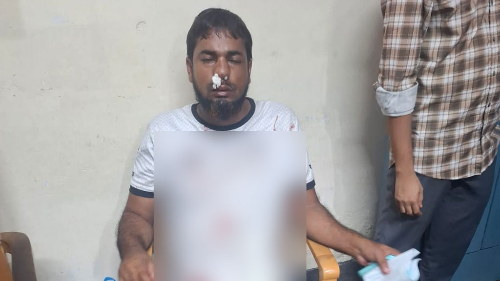 পাথরঘাটায় কলেজশিক্ষকদের বিরুদ্ধে ব্যবসায়ীকে মারধরের অভিযোগ
