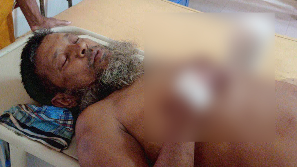 নবীনগরে ভাতিজার দায়ের কোপে চাচার কবজি বিচ্ছিন্নের অভিযোগ