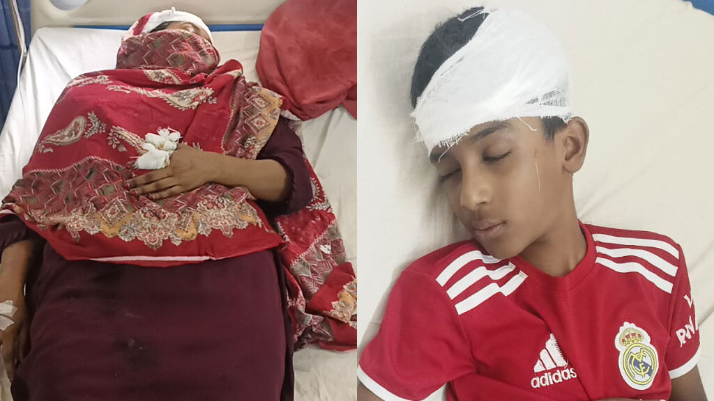 গ্যাস বিস্ফোরণে মা-ছেলেসহ আহত ৩