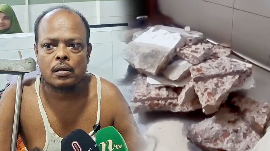 ফোড়া কাটাতে হাসপাতালে, বিদায়ের আগে প্রতিবন্ধী রোগীর মাথার খসে পড়ল পলেস্তারা