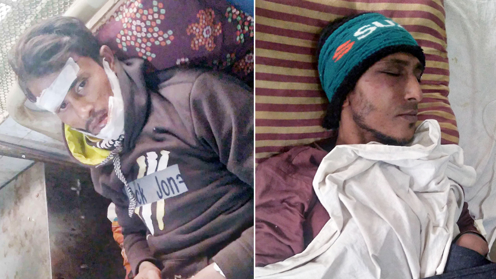 বাড়ির মালিককে কামড়ে পালানোর চেষ্টা চোরের, দুজনেই হাসপাতালে