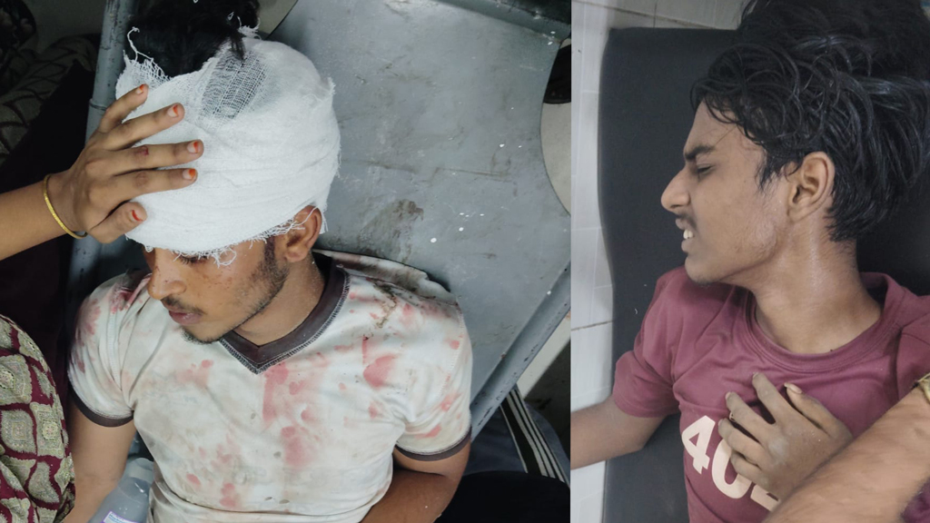 চাঁপাইনবাবগঞ্জে কিশোর গ্যাংয়ের দুই পক্ষের সংঘর্ষে আহত ৪