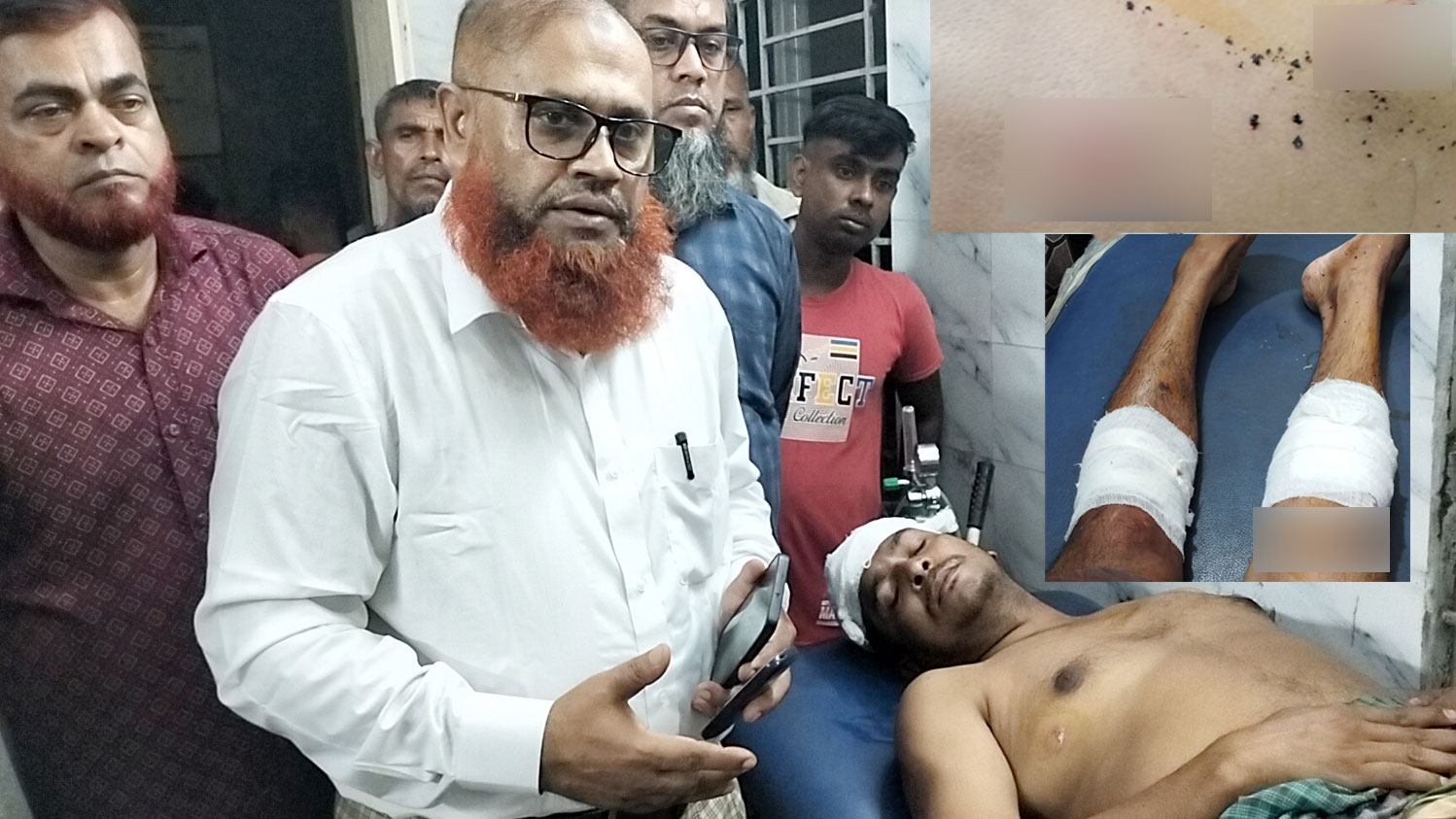 চিতলমারীতে সিমেন্ট ব্যবসায়ীকে পিটিয়ে ও কুপিয়ে জখম