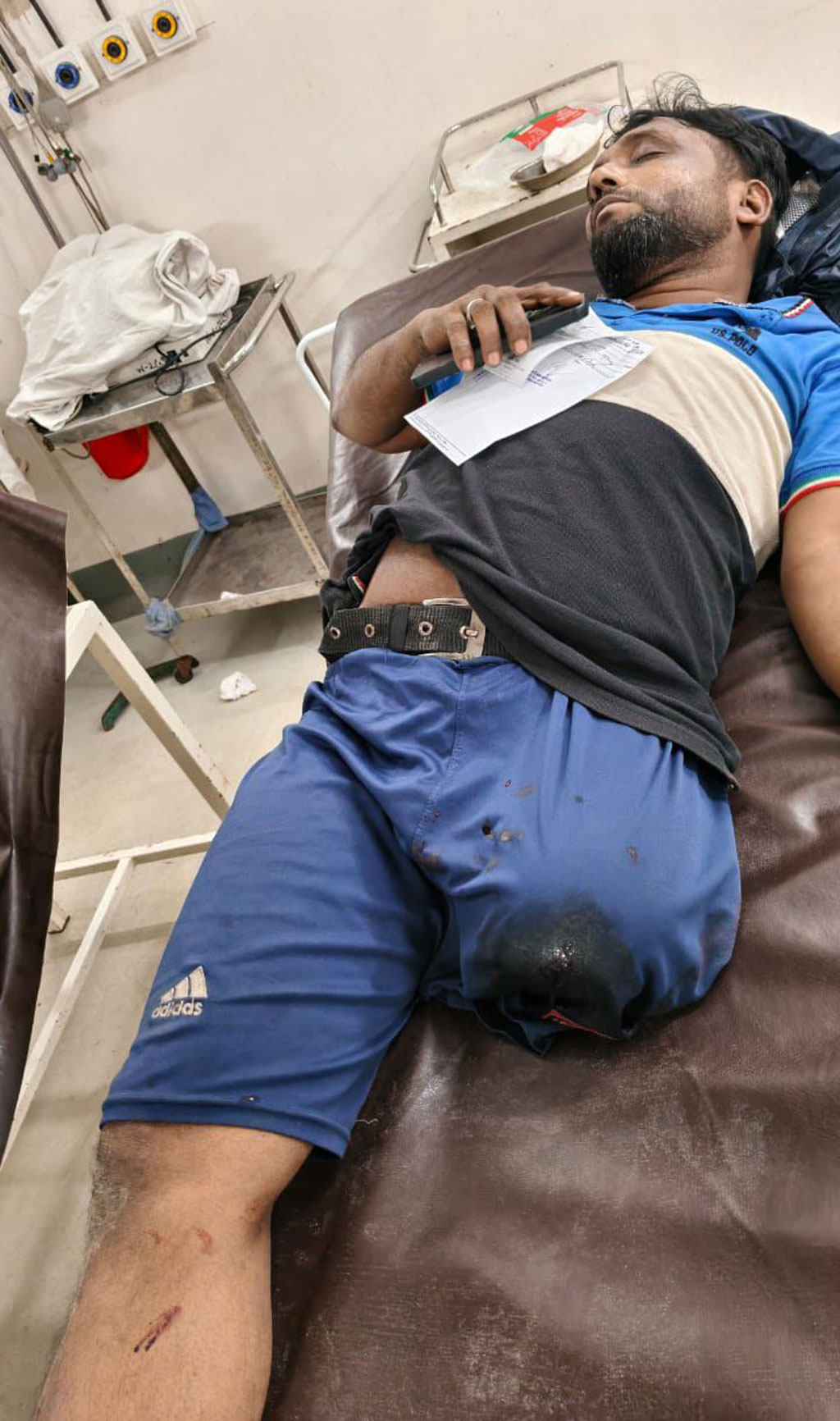 দুর্বৃত্তের গুলিতে আহত মো. ইদ্রিস। ছবি: সংগৃহীত