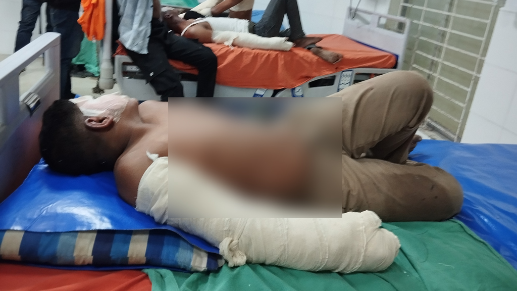 টঙ্গীতে বিএনপির সমাবেশের আগে গ্যাস বেলুন বিস্ফোরণে দগ্ধ ১৮