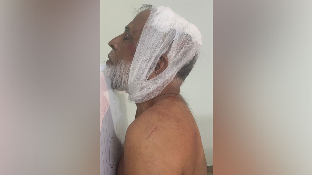 দাউদকান্দিতে কৃষক দলের সভাপতিকে কোপাল বিএনপি নেতার সমর্থকেরা