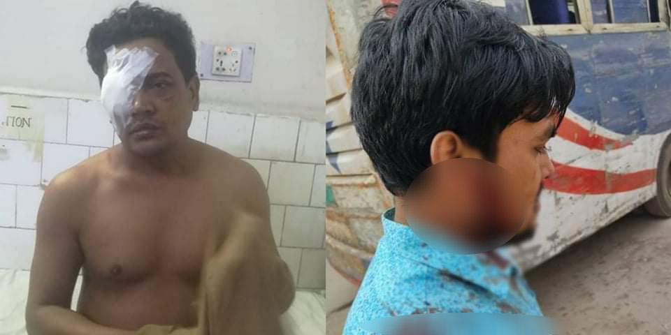 হোটেলে বসা নিয়ে বিতণ্ডা, মালিকের দুই ছেলে ও জবির দুই শিক্ষার্থী আহত