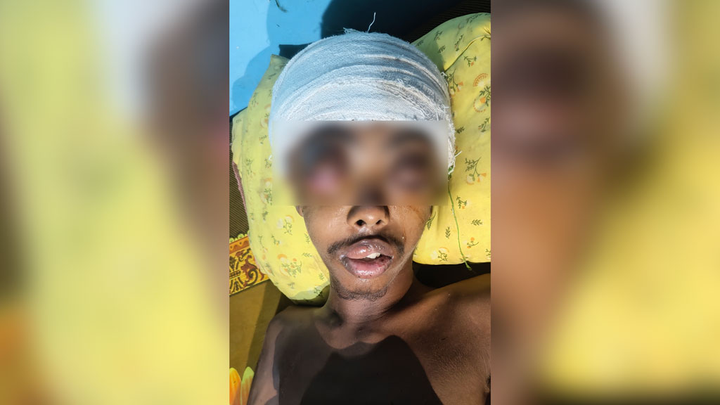 সাভারে নির্যাতনের শিকার কিশোর চোখে দেখতে পাচ্ছে না, ছাত্রদল নেতা বহিষ্কার