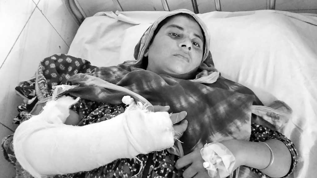 স্ত্রীর হাত ভেঙে দিলেন স্বামী