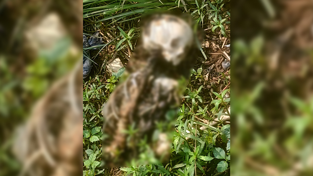 গাজীপুরে ময়লার স্তূপে মিলল মানুষের কঙ্কাল