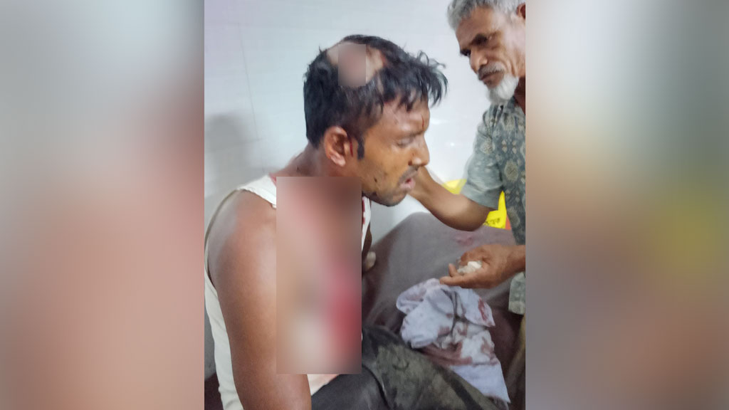 গঙ্গাচড়ায় চালককে ছুরিকাঘাত করে অটোরিকশা ছিনতাই