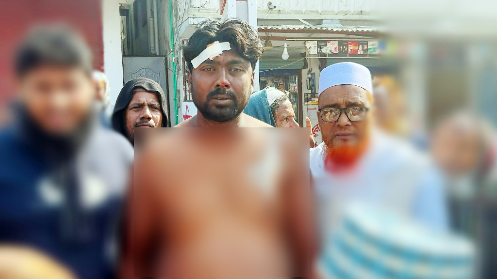 গাংনীতে প্রতিপক্ষের হামলায় ৩ জামায়াত কর্মী আহত