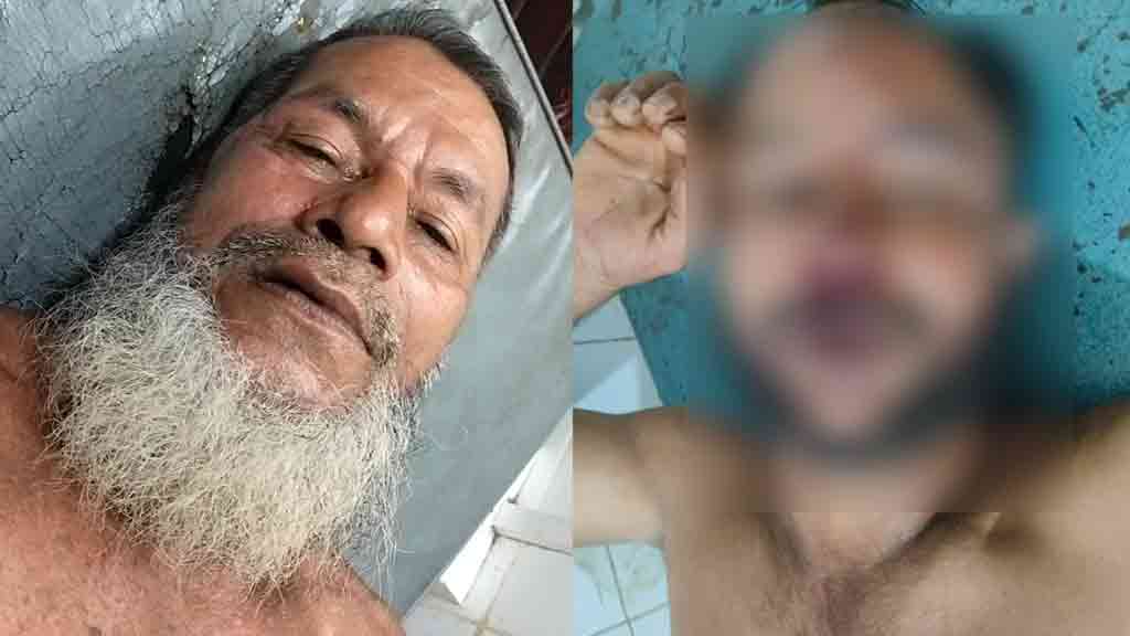 জামিনে বেরিয়েই মামলার বাদীর ওপর হামলা, আহত ২