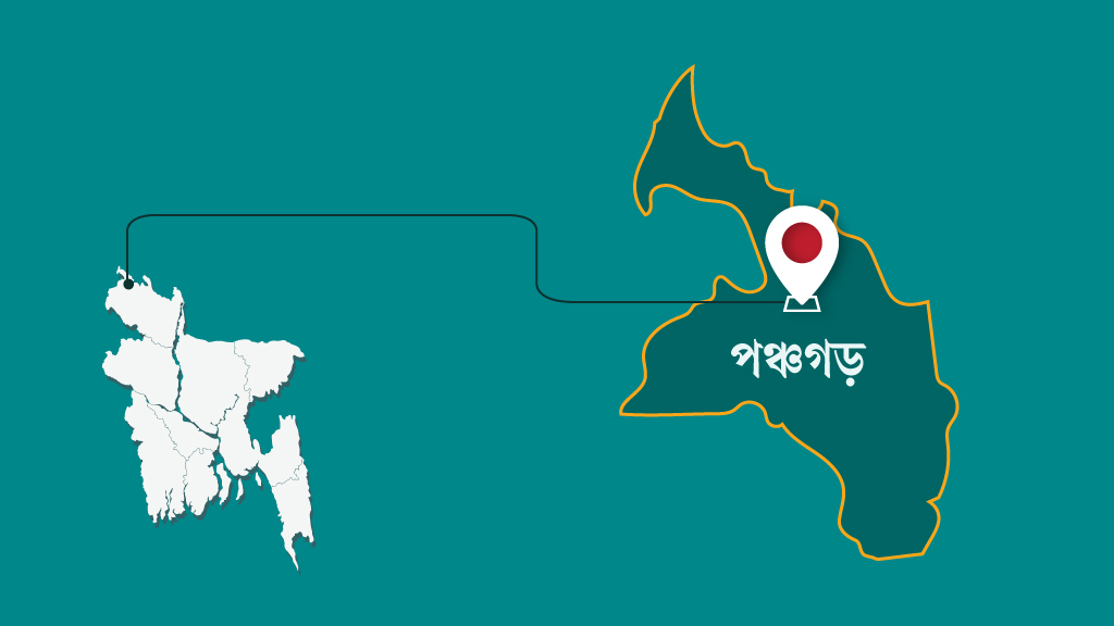 পঞ্চগড়ে দুই মাথাওয়ালা শিশুর জন্ম, পরে চিকিৎসাধীন অবস্থায় মৃত্যু