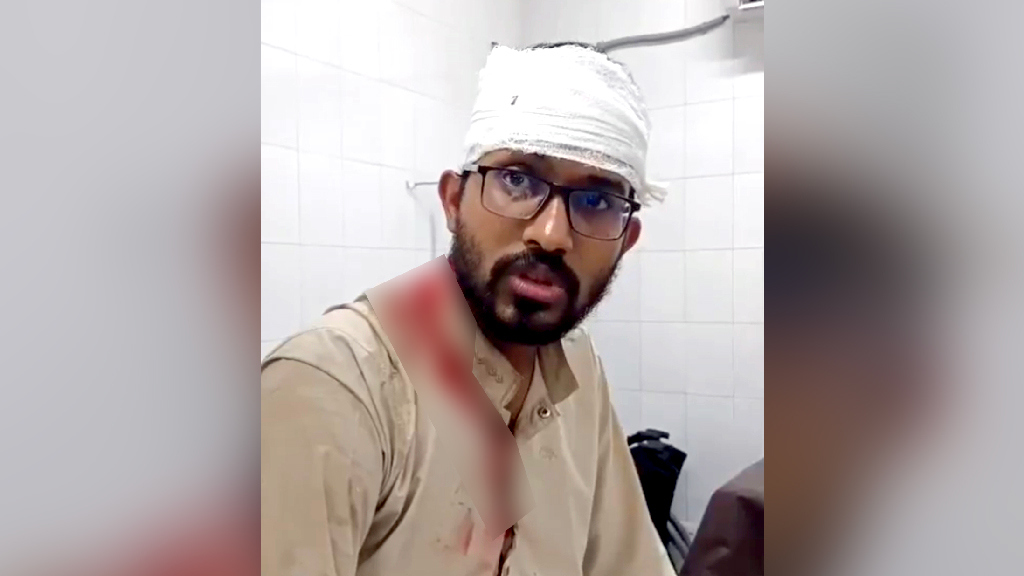 জকসুর স্বাস্থ্য সম্পাদকের ওপর হামলা, আহত ৭