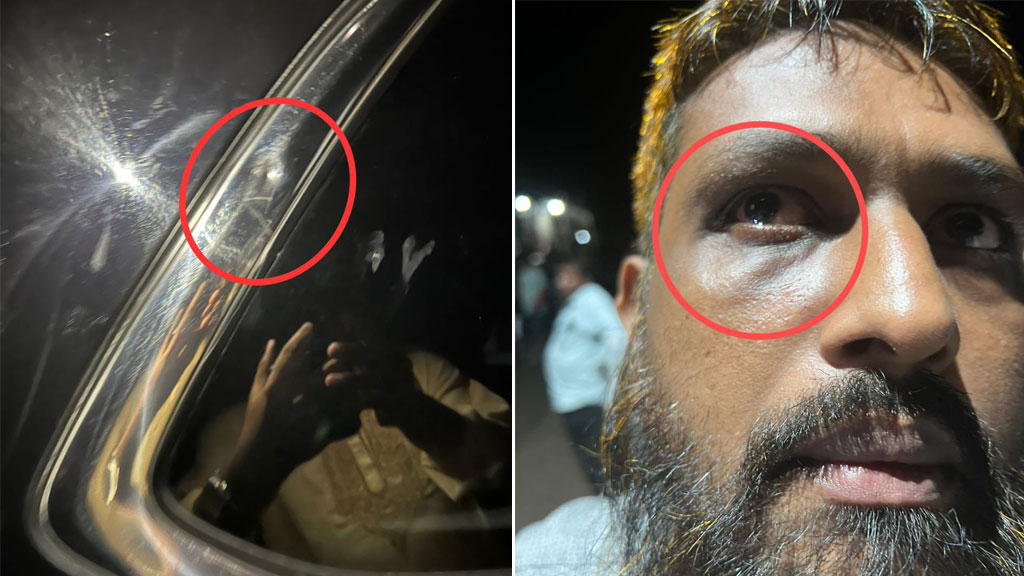 ঝালকাঠি বিএনপিতে অভ্যন্তরীণ কোন্দল: দুই নেতার অনুসারীদের সংঘর্ষে আহত ১০