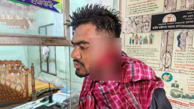 ভাগনিজামাইকে কুপিয়ে জখম করলেন মামাশ্বশুর