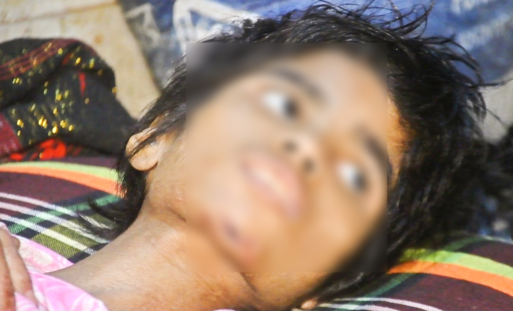 হাড্ডিসার শরীরজুড়ে ক্ষত গৃহকর্মী শিশুটির
