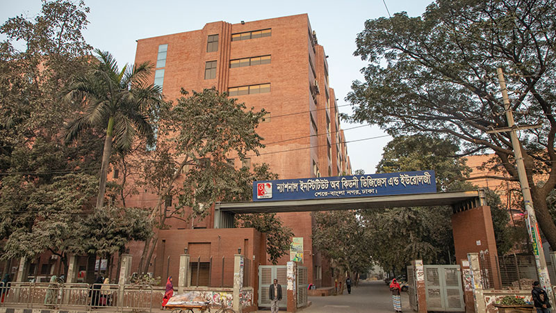 ২১ বছরে মাত্র ৮৬টি কিডনি প্রতিস্থাপন