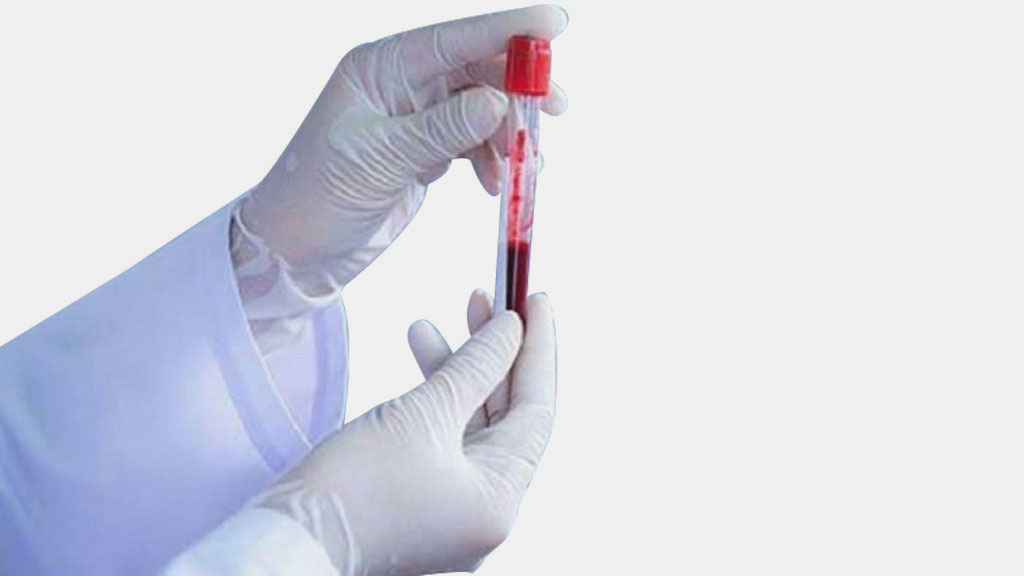 শাহজালালে অগ্নিকাণ্ড: আসছে না রি-এজেন্ট চমেকে বন্ধ ৩ পরীক্ষা