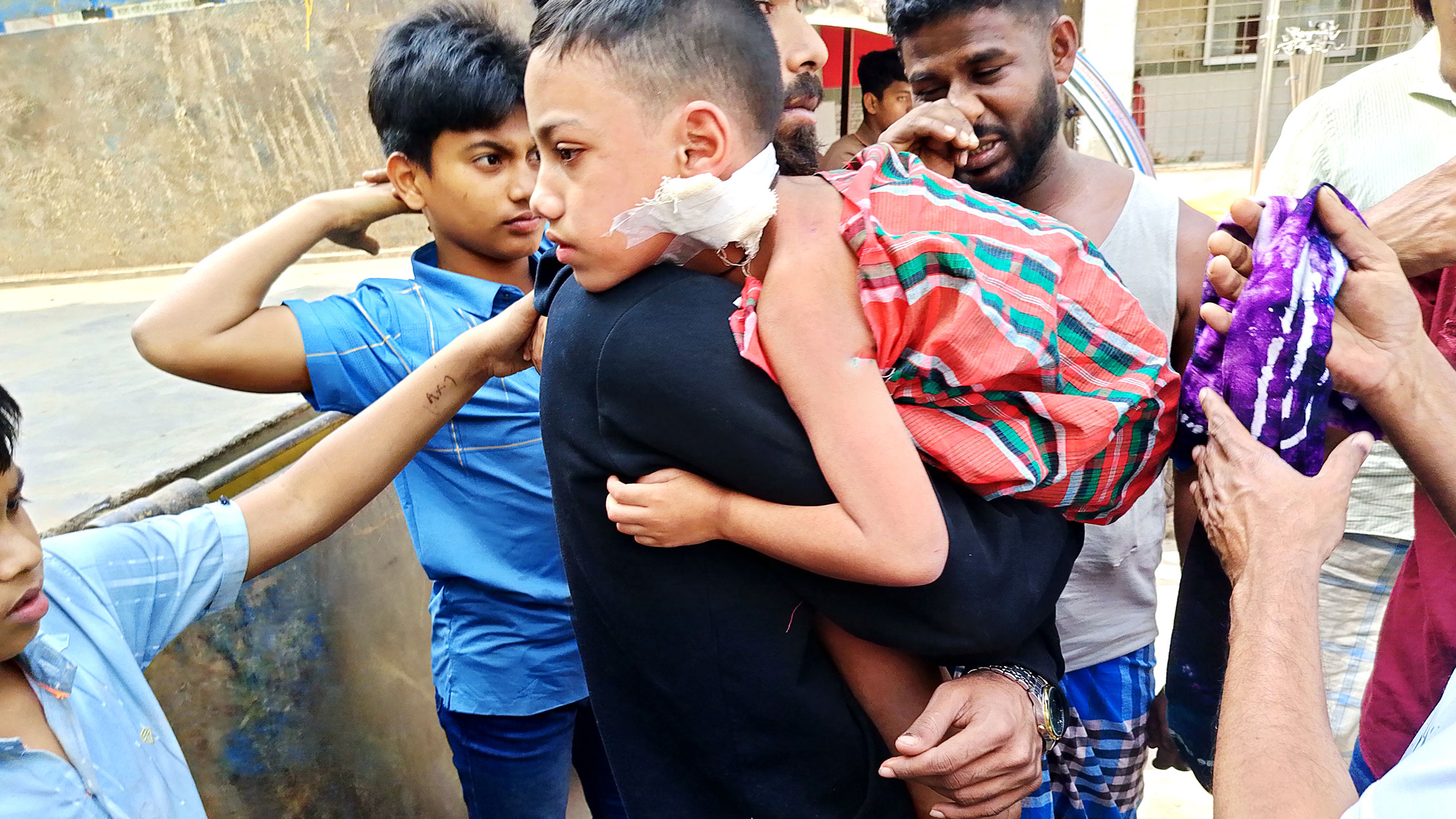 কুকুরের কামড়: হাসপাতালে টিকা নেই বিপাকে এলাকাবাসী