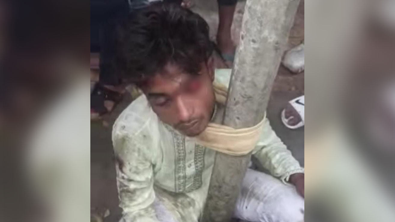 চুরির অভিযোগে যুবককে বেঁধে বেধড়ক পিটুনি, শরীরে জখমসহ ভাঙা হলো পা