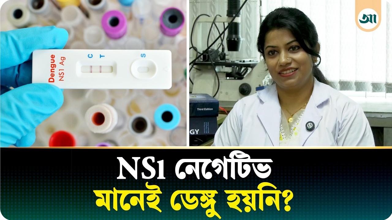 NS1 নেগেটিভ মানেই কি ডেঙ্গু হয়নি, CBC কি প্রতিদিন করতে হবে