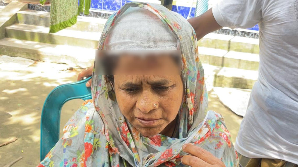 নেশা ও জুয়ার টাকা না পেয়ে মায়ের মাথা ফাটালেন যুবক