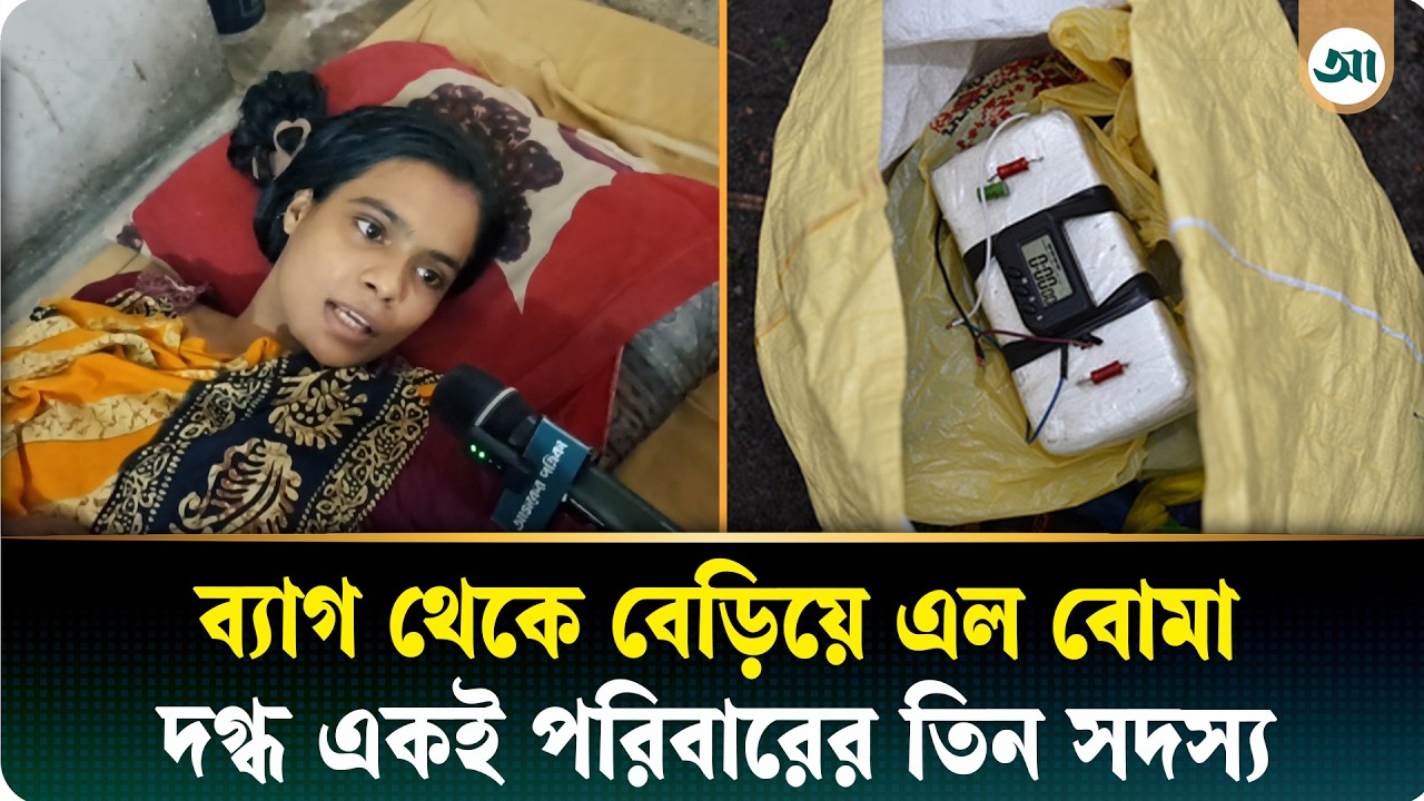 চিপসের প্যাকেট ধরতেই বিকট আওয়াজ, হাসপাতালে একই পরিবারের ৩ জন