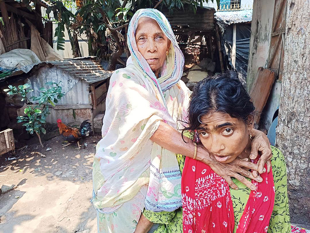 মাদারীপুর শহরের বাসিন্দা আমেনা বেগম প্রতিবন্ধী মেয়ের সেবা করতে করতে নিজেও অসুস্থ হয়ে পড়েছেন। ছবি: আজকের পত্রিকা