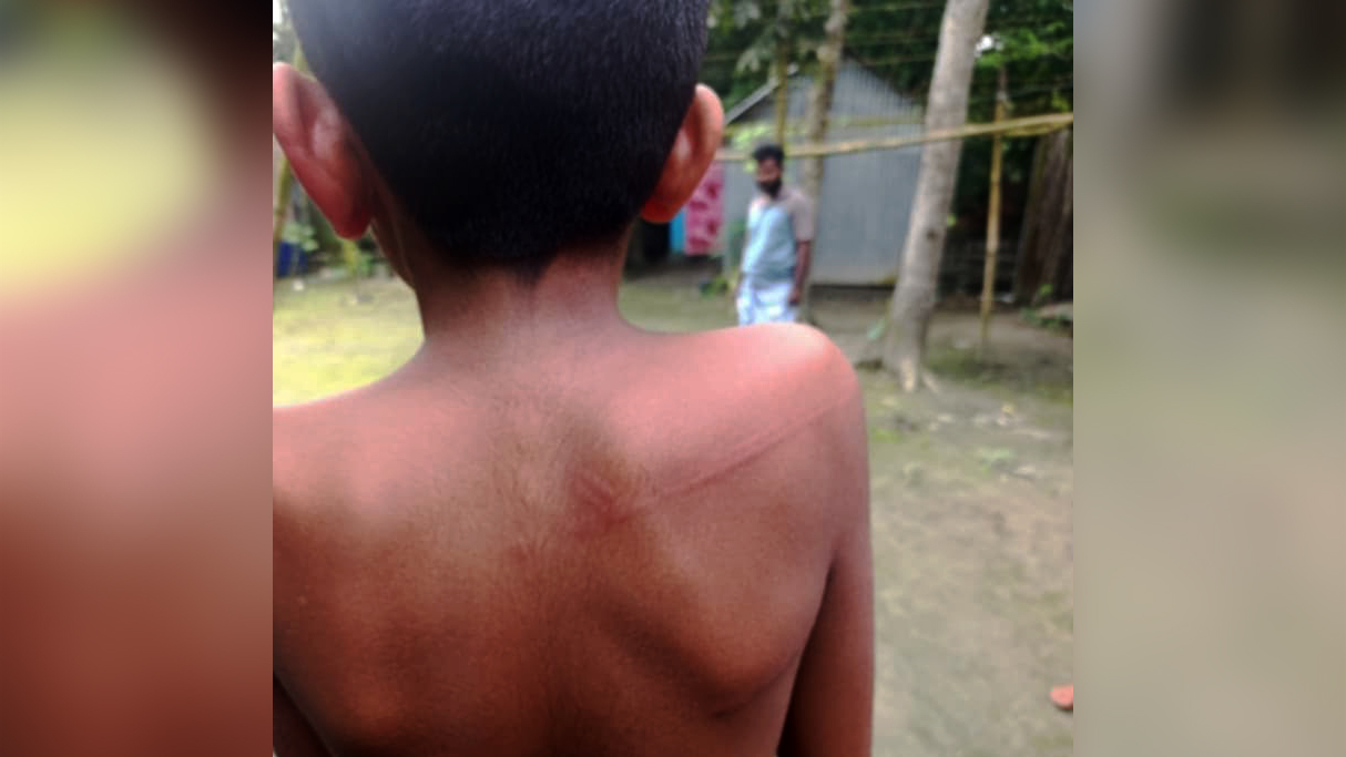 শিক্ষকের মারধরে অচেতন মাদ্রাসাছাত্র হাসপাতালে