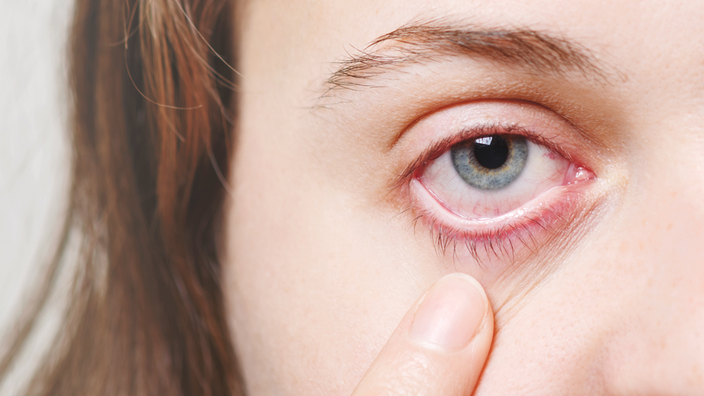 ব্যাডমিন্টন খেলায় চোখে আঘাত পেলে করণীয়