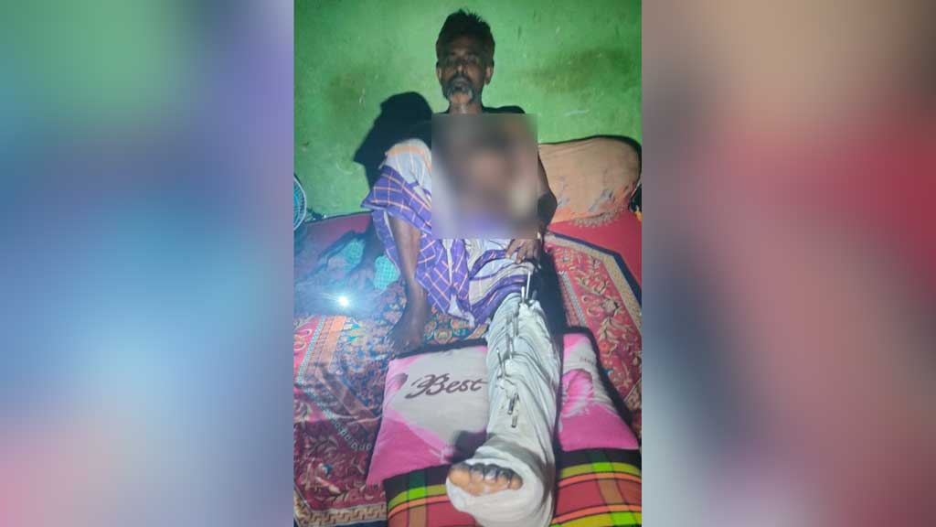 মুলাদীতে কৃষককে পিটিয়ে পা ভাঙার অভিযোগ, গ্রেপ্তার ১