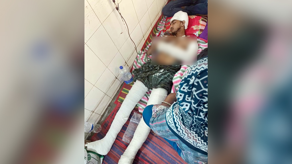 নিষিদ্ধ ছাত্রলীগ নেতার হাত-পায়ের রগ কর্তন