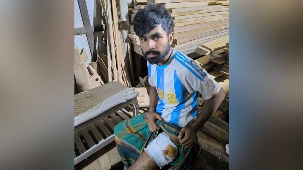 আসল পিস্তল কি না—জানতে চাওয়ায় গুলি, নিজেই হাসপাতালে নিলেন গুলিবিদ্ধকে