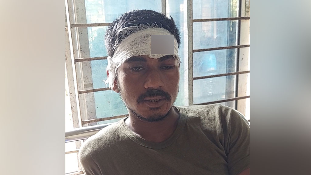 সিগারেটের দাম নিয়ে বাগ্‌বিতণ্ডা, ক্রেতার মাথা ফাটালেন ব্যবসায়ী