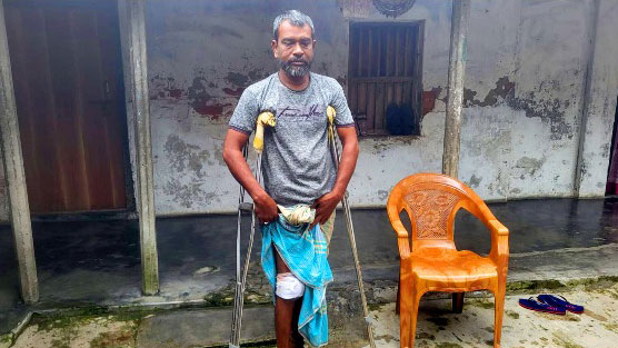 চিকিৎসকের বিচার দাবি: ভুল অস্ত্রোপচারে মৃত্যু কৃষকের,পঙ্গু হওয়ার পথে ৩