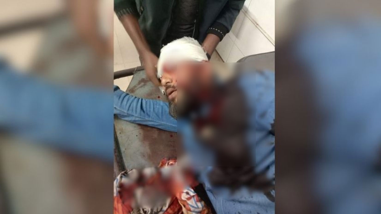 খুলনায় এনসিপি নেতাকে মাথায় গুলি, অবস্থা গুরুতর