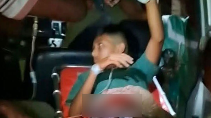 মাদারীপুরে আতশবাজি ফোটাতে গিয়ে স্কুলছাত্র গুরুতর আহত