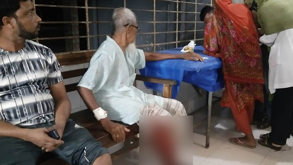 বদলগাছীতে কুকুরের কামড়ে শিশুসহ তিনজন আহত