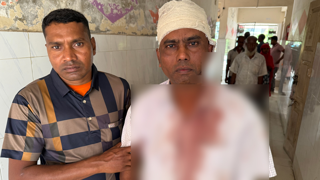 ধামইরহাটে স্ত্রীর বিরুদ্ধে স্বামীকে হত্যাচেষ্টার অভিযোগ