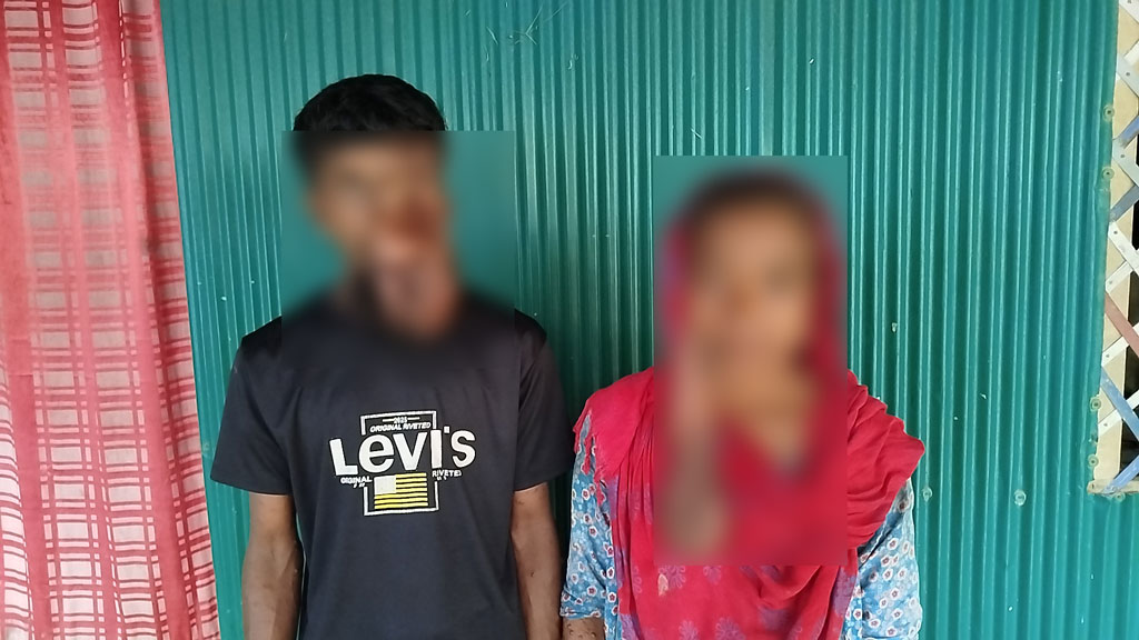 বিরল টিউমারে মুখ ঢেকেছে মা-ছেলের, অসহায় পরিবার