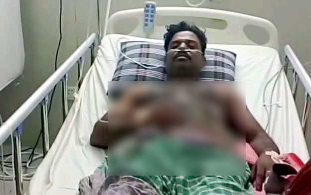 সমালোচনার মুখে পূর্ণাঙ্গ চিকিৎসা না নিয়েই হাসপাতাল ছাড়লেন সাপুড়ে ইমরান